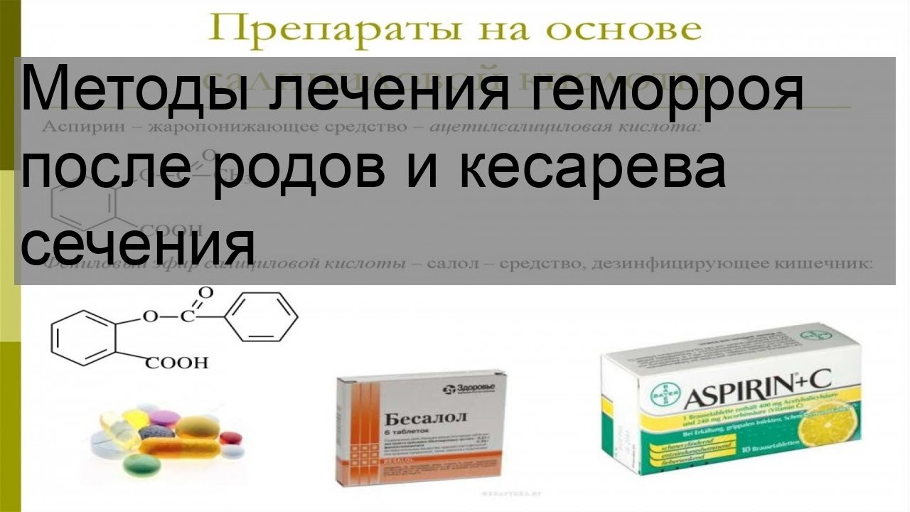 Методы лечения геморроя после родов и кесарева сечения