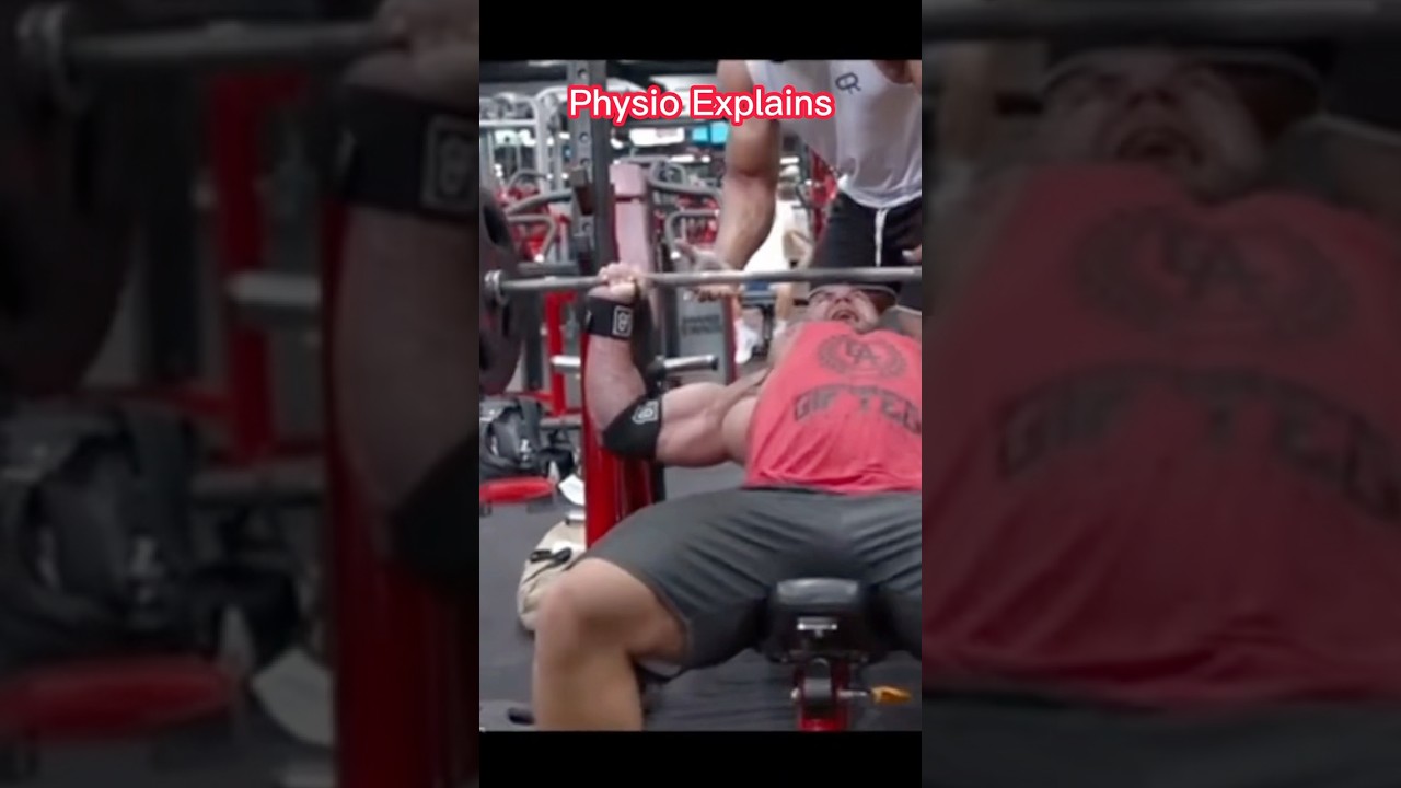 Pec Muscle Tear: Physio Explains 