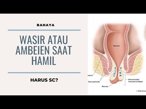 Video: Salep Heparin Untuk Wasir: Ulasan, Gunakan Selama Kehamilan