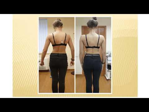 Коллаген - особенности приема. Для чего нужен и кому?! - YouTube