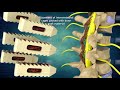 Thoracic Spine Injuries