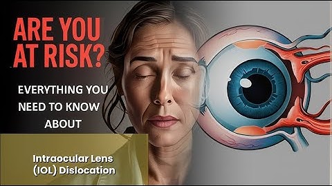 Intraocular Lens (IOL) Dislocation Explained Causes, Symptoms and Treatment, All Insights