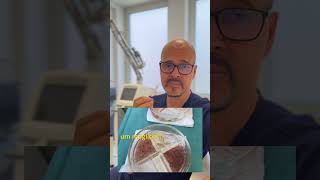 DHI-Haartransplantation
