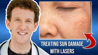 Can Sun Damage be Reversed with Lasers? How Lasers Could Help Treat Sun Damage Prevent Future Risk