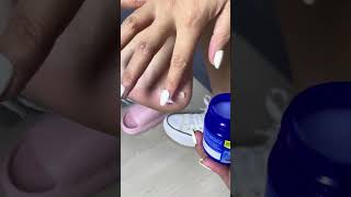 Try Vicks On Your Feet For Instant Relief