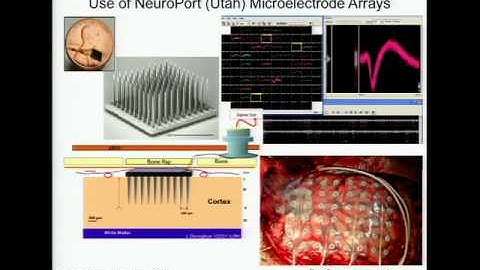 Neurons, neuronal populations and networks during seizure initiation, propagation and termination