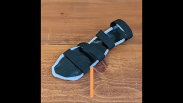 Hand Therapy Week: Custom Orthoses