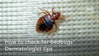 How to check for bedbugs: Dermatologist tips