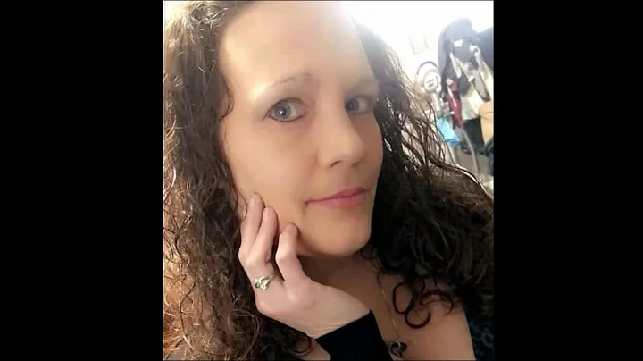 Survivor Of TBI, Then The Unthinkable Happened-Kid...