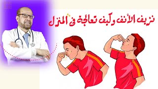 أسباب نزيف الأنف وكيف نعالجة فى المنزل دكتور جودة / مجمد عواد