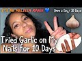 Trying Garlic on my Nails for 10 days ‼️ It’s Me Melissa Marie 💙