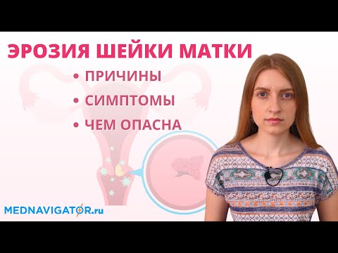 ЭРОЗИЯ ШЕЙКИ МАТКИ
