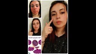 مع خبيرة التجميل loubna nature قولي وداعا للمكياج وشحوب الوجه??