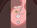 Why did she still get pregnant even with an IUD?#shorts #funny #hot