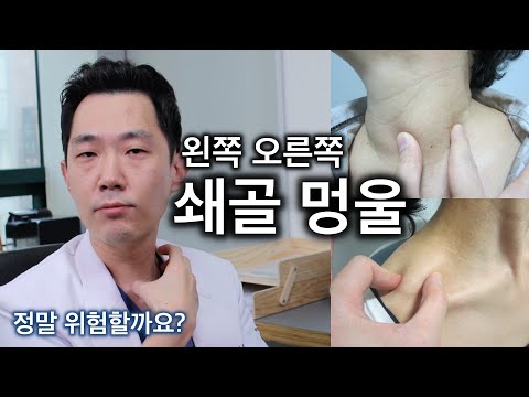 (오른쪽 왼쪽) 목 옆, 쇄골에 멍울, 림프절 - 정말로 위험한 위치인가요? 팩트만 정리해봅니다 : 위드심의원 조우진 원장