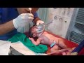 New born baby delivred by vvd baby having a no breath i tried my best to save passing ett tube 