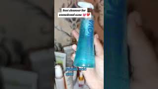 Zenova Face Cleanser Stans No. 1 Skincare Choice