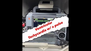 Ventricular Tachycardia w/ Pulse || Cardiac Rhythms || Paramedic/EMS Cardiology