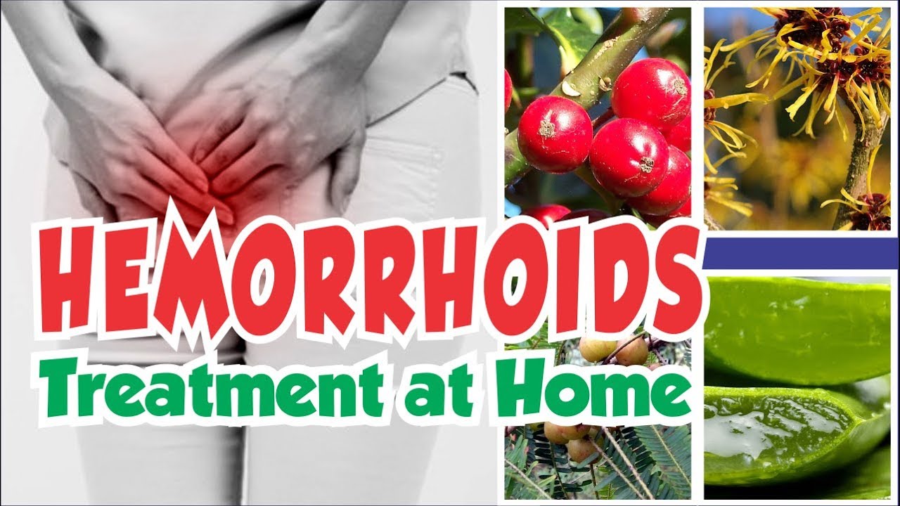 how to get rid of flies How To Treat Hemorrhoids At Home With Natural Ingredient