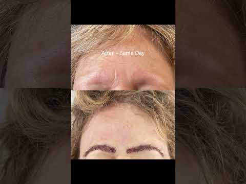 From Bare to