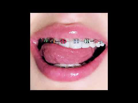 GAVRILINA - Брекеты (1ЧАС)