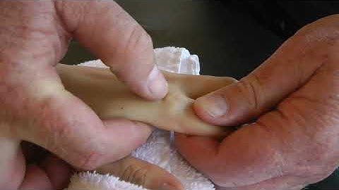 Page 91, 92, 98  MCP, PIP, DIp Jts  Dorsal and Palmar Glides