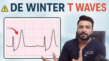 De Winter T-golven uitgelegd | Het verborgen STEMI-equivalent op het ECG