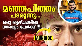 1775: മഞ്ഞപിത്തം വ്യാപിക്കുന്നു എങ്ങനെ തടയാം? എന്താണ് ഒറ്റമൂലി? | Prevention of Jaundice ?