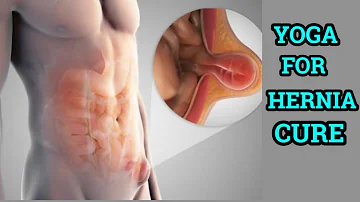 Yoga Poses to Treat Hernia| Inguinal Hernia,Umbilical Hernia,Hiatus Hernia |Yoga for all type hernia