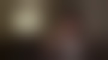 Sulcus IOL Placement