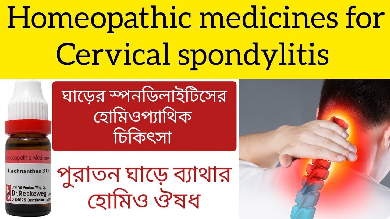 স্পন্ডিলাইটিসের হোমিও ঔষধ পুরাতন ঘাড়ে ব্যাথাHomeopathic medicines