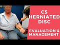 Cervical Radiculopathy Evaluation and Management