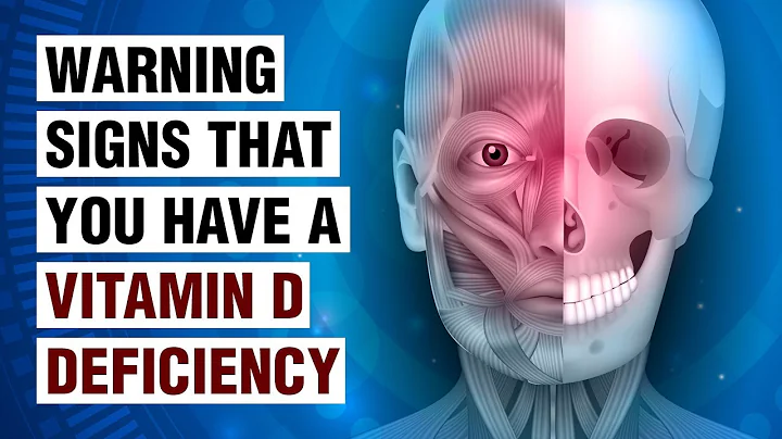 14 Anzeichen eines Vitamin-D-Mangels - Wie man ihn erkennen und beheben kann