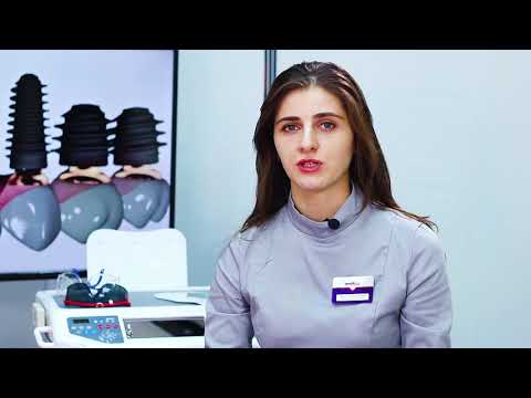 Имплантация без костной пластики. Плюсы и минусы.