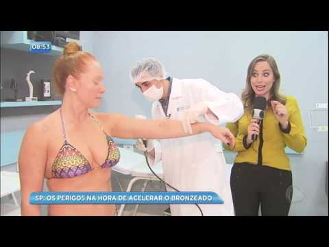 Vídeo: Injecções De Bronzeamento: Riscos, Efeitos Colaterais E Precauções