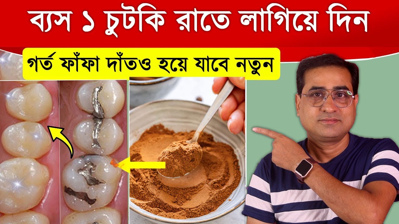 দাঁতের যেকোনো সমস্যার সমাধান | গর্ত হওয়া, ফাঁফা, পোকা লাগা ও হলুদ দাঁত থেকে মুক্তি পান