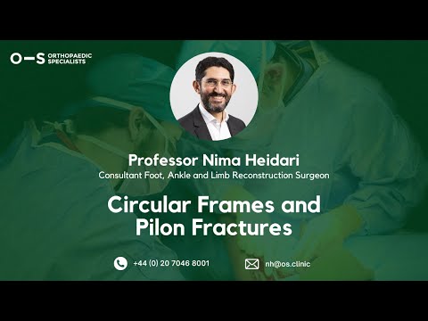 Circular Frames and Pilon Fractures | Professor Nima Heidari | Orthopaedic Specialists