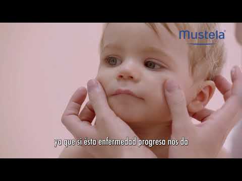 Vídeo: Mustela Stelatopia - Instrucciones De Uso, Revisiones