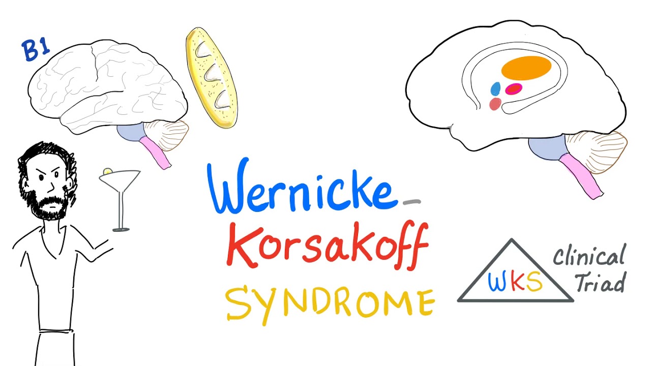 Pathophysiology Of Wernicke Syndrome