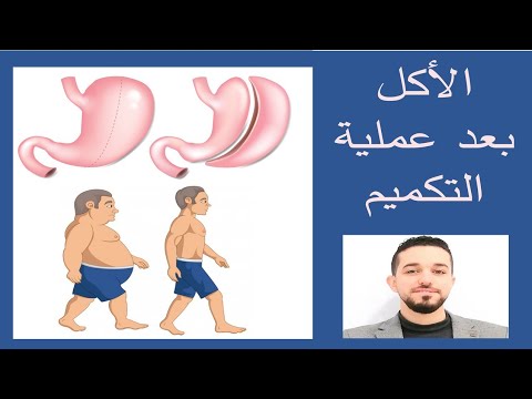 الأكل بعد تكميم المعدة |النظام الغذائي بعد عمليات السمنة|الفيتامينات والمكملات بعد التكميم