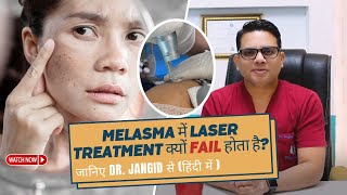 Why Laser Treatment failed in Melasma ? Best Treatment for Melasma | Laser Treatment for Melasma