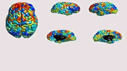 Brain activity with fMRI