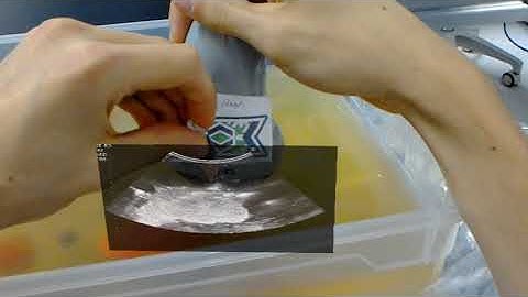 Ultrasound + Augmented Reality