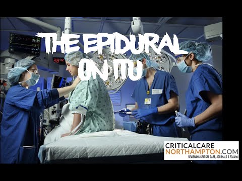 Video: Orsakar epidural skakning?