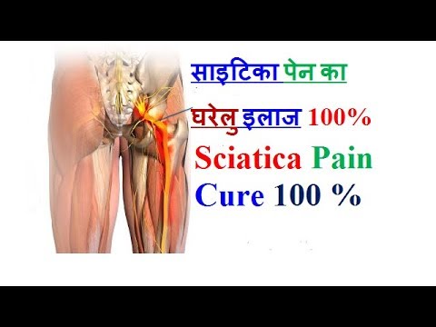 sciatica-pain-cure-100%-,-how-to-cure-sciatica-pain