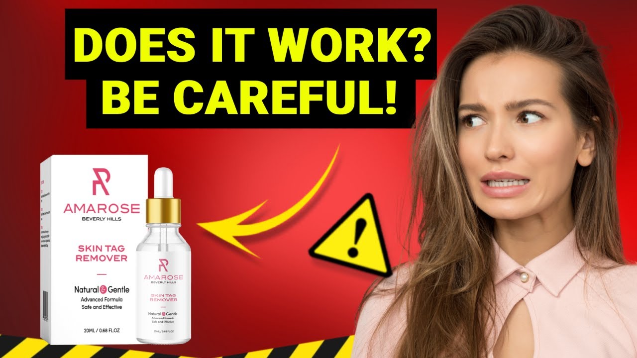 ALERT My Honest Amarose Skin Tag Remover Reviews Does Amarose Skin alert-my-honest-amarose-skin-tag-remover-reviews-does-amarose-skin