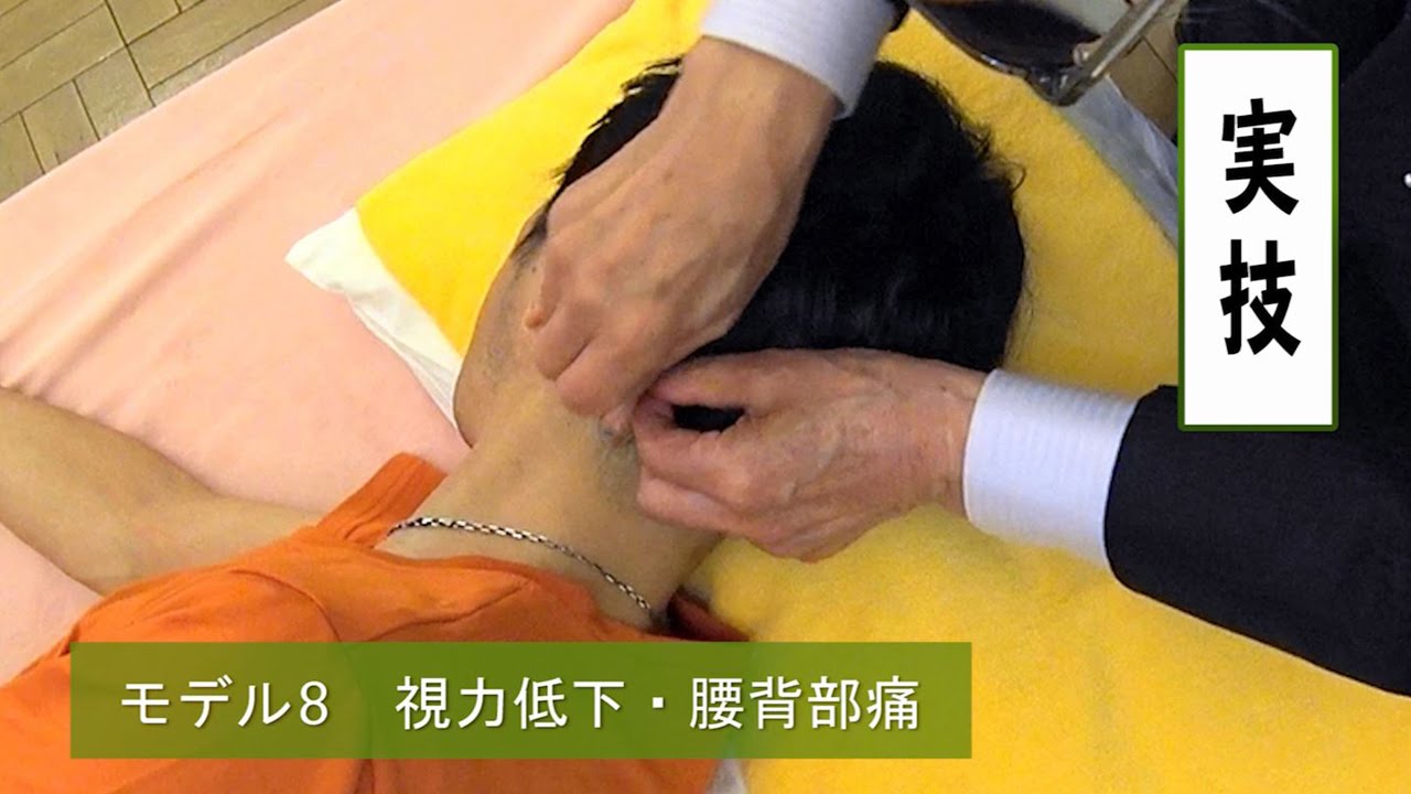 【鍼灸】 第30回弦躋塾セミナー 8/9　首藤傳明 The 30th Gensaijuku Seminar　Shudo Denmei