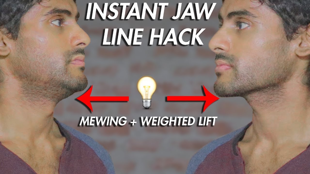 Mewing: Before and After the Jawline Defining Trick