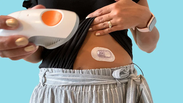 How to Change Your Dexcom G6 CGM - Easy to follow guide