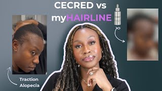 Cecred Edge Drops for my TRACTION ALOPECIA + this Boosted my Growth